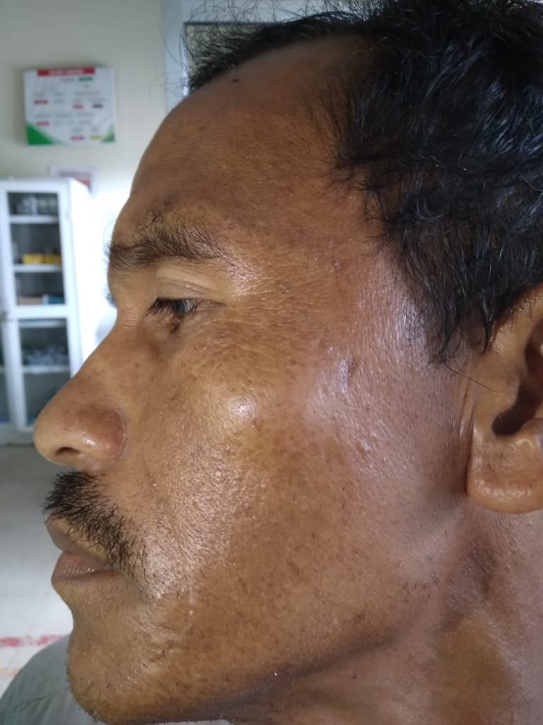 Korban